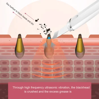 Ultrazvukové Pokožky Práčky Blackhead Odstraňovač Riediteľný, Čistiaci Peeling Lopatu Čistiaci Peeling Na Tvár Vibrácií Masér