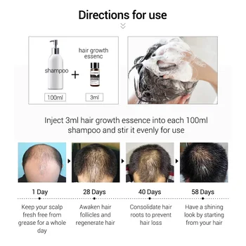 LANBENA Rýchlo Silný Rast Vlasov Podstate Produktov Esenciálny Olej, Liečba, Prevencia vypadávania Vlasov Starostlivosť o Vlasy Andrea 20ml