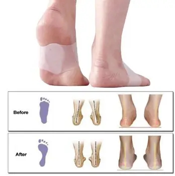 Pro Arch Podporuje Gél Arch Protetických Rovnátka Flatfoot Corrector Obväz Nohy Pad Anti-Shock Nohy Masážny Vankúš