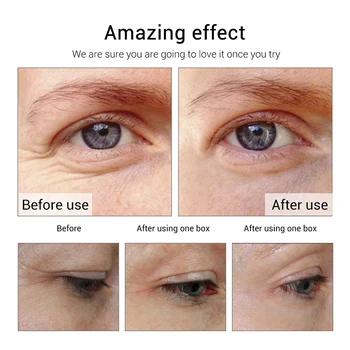 AuQuest Peptidy Proti Vráskam Očný Krém Hydratačné Kože Zdvíhacie Anti-Opuchy temný Kruh Underbag Starostlivosť o Oči 20 G