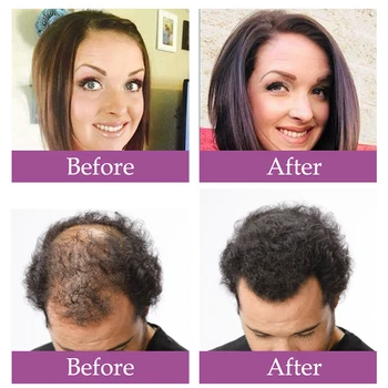 HAIRCUBE Proti vypadávaniu Vlasov Sprej Rast Vlasov Esenciálny Olej Pre Mužov, Ženy Suché Vlasy, Regenerácie, Opravy Strata Vlasov Vlasové Tonikum