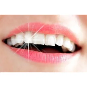 Zubné Zariadenia FDA štandardné Zuby Bielenie zubov 44% Peroxidu, Bieliace Systém, Ústna hygiena, starostlivosť Gél na dym zuby
