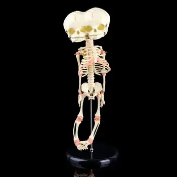 Ľudské Dieťa Deformovaný Hlava Lebka Výskumu Model Kostry Anatomické Anatómie Mozgu