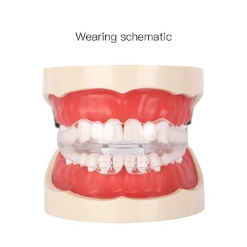 AZDENT Mäkké a Tvrdé Zubné Ortodontická Zariadenie Aligners Vaničky Zuby Straightener High-tech Zubné Transparentné Zuby Držiak
