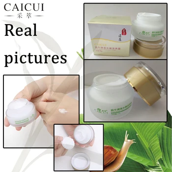 10 ks CAICUI Slimák Day Cream Krém na Tvár Liečba Akné Hydratačný Anti Anti Aging Vrásky bielenie pokožky Tváre Starostlivosť Nastaviť
