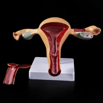 Ľudské Patologické Maternice, Vaječníkov Model Anatomický Anatómie Chorôb Patológia Lekárske Lézie Na Vyučovanie Dropshipping