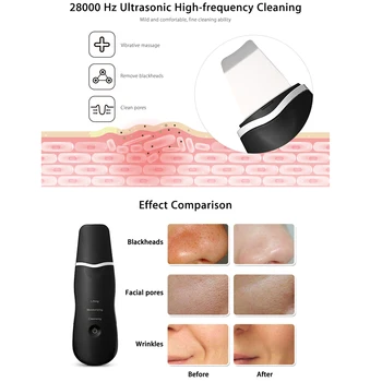 Ultrazvukový Peeling Pokožky Stroj Ultrazvukové Práčky Lopatu Cleaner Blackhead Akné Odstránenie Hlboko Čistí Pleťové Zdvíhacie Masér